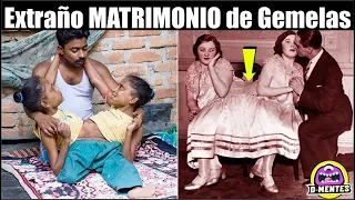 Así es Como Viven en Matrimonio Estas Gemelas Siameses