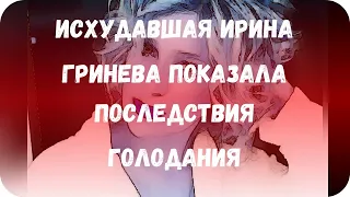 Исхудавшая Ирина Гринева показала последствия голодания