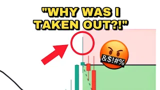 What You NEED To Know For Placing Stop-Losses! (Quick Tip For Traders)⚠️ #shorts