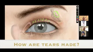 Tear Formation | TeleShadowing