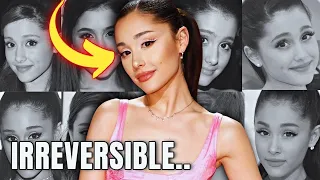 What "HAPPENED" to Ariana Grande's EYES? - Plastic Surgery Analysis