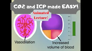 Carbon Dioxide & Intracranial Pressure (ICP): Effects of CO2 on blood vessels.