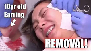 REMOVING An Earring That Was STUCK for 10 YEARS!