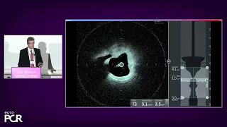 The future of physiology- and morphology-guided PCI is optical! EuroPCR 2023