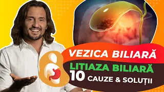 Dr Cezar: Vezica biliară I Litiaza biliară - 10 cauze și soluții