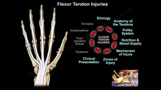 Flexor Tendon Injuries - Everything You Need To Know - Dr. Nabil Ebraheim