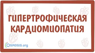 Гипертрофическая кардиомиопатия — причины, симптомы, патогенез, диагностика, лечение