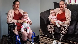 Mother Has Legs Amputated After Giving Birth