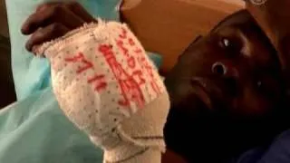 Инвалидам на Гаити не хватает денег на протезы