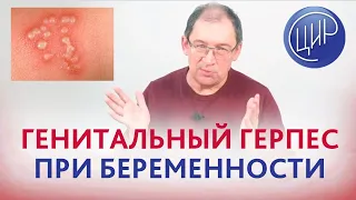 Генитальный герпес, обострение при беременности. Влияние на плод.