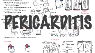 Pericarditis - Overview (signs and symptoms, pathophysiology, diagnosis, treatment)