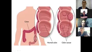 Patología de resolución Quirúrgica. Cirugía intestinal