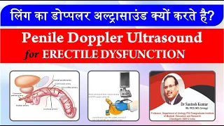 Penile Doppler(ultrasound). लिंग का डॉपलर अल्ट्रासाउंड क्यों करते है | Dr.(Prof)Santosh Kumar PGI.