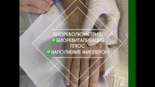 Наполнение кожи рук. Dr.Shinder