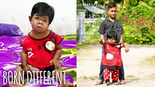 The 30-Year-Old Trapped In A Toddler's Body | BORN DIFFERENT