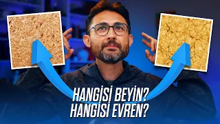 Bu iki görselden birisi insan beyni, diğeri evren! Arada ne fark var?