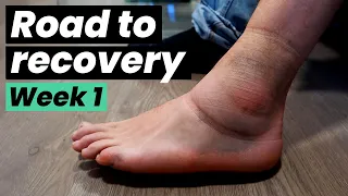 Road to Recovery - The Ankle Sprain Rehab Chronicles | week 1