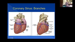 Cardiac Anatomy for the EP World - Pt 1