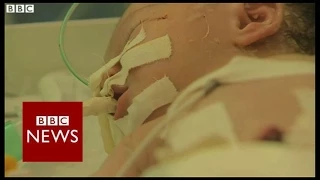 Gaza baby delivered from dead mother - BBC News