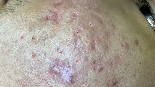 Satisfying Relaxing with Sac Dep Spa Video (#233)