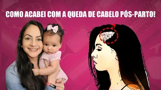 4 COISAS QUE ACABARAM COM MINHA QUEDA DE CABELO PÓS-PARTO!