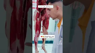 تشريح جثة واقفة .. شاهد المنظر ولن تصدق🤢🤢🤢🤢