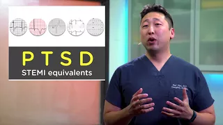 STEMI Equivalents for ECGs