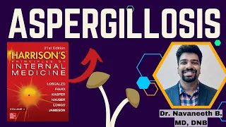 ASPERGILLOSIS | Pathogenesis | Clinical Features | Diagnosis | Treatment | Harrison