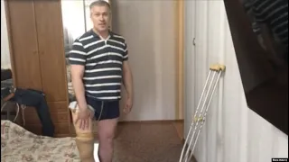 Неравная борьба Олега Шарапатюка за протез