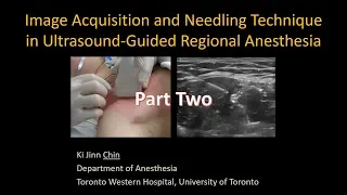 Image Acquisition and Needling in Ultrasound-Guided Interventional Procedures - Part 2