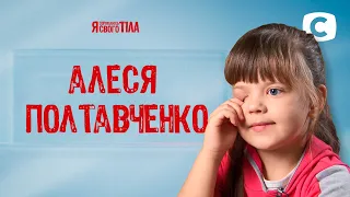 8-летняя Алеся Полтавченко страдает от сильной боли в глазах – Я стесняюсь своего тела 2020