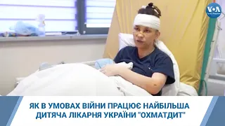 Як в умовах війни працює найбільша дитяча лікарня України "Охматдит"