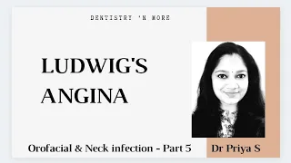 LUDWIG'S ANGINA(OROFACIAL AND NECK INFECTION -PART 5)