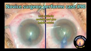 evaluation of a novice surgeon performing cataract surgery