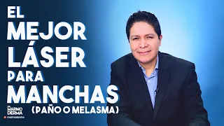 El mejor laser para manchas (paño melasma) Dr Marino Dermatologo