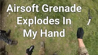 Airsoft Grenade Explodes In My Hand