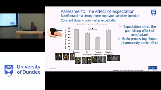 Grand Rounds 23-01-2020 Challenges of Chronic Pain Management