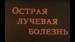 "Острая лучевая болезнь", 1988