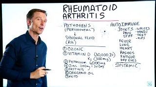 Ревматоидный артрит: 7 средств  в помощь!