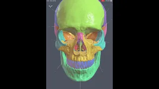 MSS Anatomy - L1 - Skull and Mandible - 3D Revision