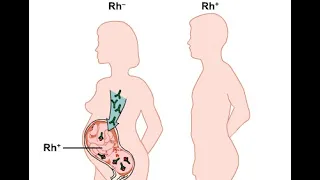Rh blood type and complications during pregnancy & Fertilization