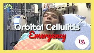 Orbital Cellulitis Emergency