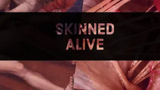 Skinned Alive: What is it like to be skinned alive
