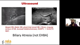 Liver Disease In An Infant