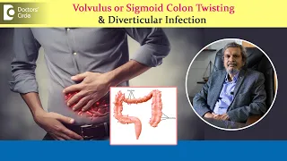 Colon Problems | Diverticular Disease in Sigmoid Colon - Dr. Rajasekhar MR | Doctors' Circle