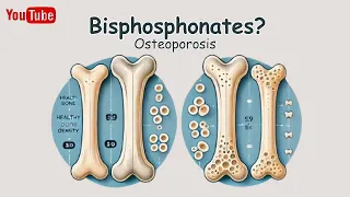 【Bisphosphonates】Why Are Bisphosphonates So Effective? : Simply Explained