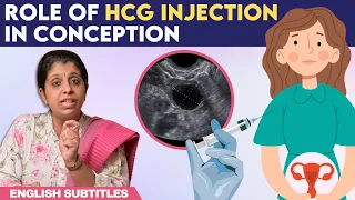 Role Of hCG Injection In Conception | hCG ஊசி செலுத்திய பிறகு கரு முட்டை எப்போது வெளிவரும்?
