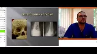 Силкин Сергей Александрович, онко-ортопед ООКБ – «Особенности онкопатологии в ортопедии»