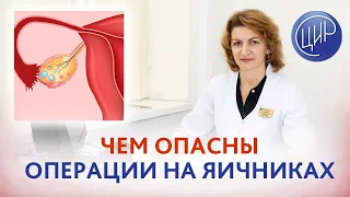 Операции на яичниках и овариальный резерв. Стоит ли удалять эндометриоидную кисту яичника?