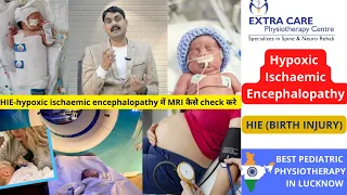 Hypoxic Ischaemic Encephalopathy | HIE in Babies| Birth Injury | Pediatric Physiotherapy in Lucknow